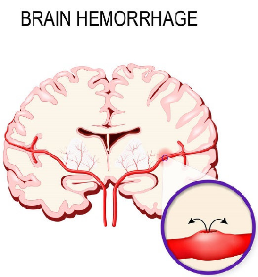 ѪƷ